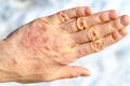 Detailed closeup of dry mature woman hand