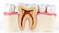 Detailed Cross-Section of Human Tooth Showing Root, Pulp, and Surrounding Bone Royalty Free Stock Photo
