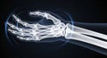 Human Hand and Wrist Bones X-ray with Blue Energy Field Royalty Free Stock Photo