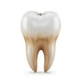Human molar tooth with stained roots and white crown on a white background dental dentistry Royalty Free Stock Photo