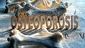 Osteoporosis concept with bones on a white background Royalty Free Stock Photo