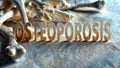 Osteoporosis concept with bones on a white background Royalty Free Stock Photo