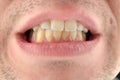 Detailed image of man showing his teeth. Dental health care. Hygiene teeth. Dentistry