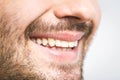 Detailed image of young man smiling with perfect white teeth. Healthy concept Royalty Free Stock Photo