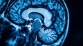 Detailed MRI Scan Analysis of a Human Brain for Biomedical Engineering Purposes Royalty Free Stock Photo