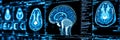 Detailed Neurological Imaging Exploring Brain Structure and Function Through Advanced Medical Scans
