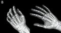 X-Ray of Human Hands Royalty Free Stock Photo