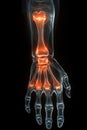 X-ray image of human forearm showing highlighted bones and joints anatomy Royalty Free Stock Photo