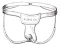 Device against masturbation in boys, vintage engraving