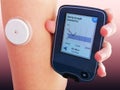 Device for continuous glucose monitoring of  blood sugar levels â CGM Royalty Free Stock Photo