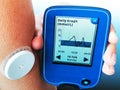 Device for continuous glucose monitoring Ã¢â¬â CGM. White sensor on arm. Daily graph on screen. Royalty Free Stock Photo