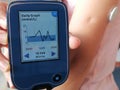 Device for continuously glucose monitoring in  blood Ã¢â¬â CGM. Diabetes type 1. Insulin depend Royalty Free Stock Photo