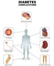 Diabetes complications