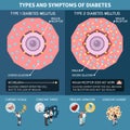 Diabetes Isometric Infographics