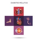 Diabetes mellitus affected organs