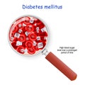 Diabetes mellitus. High blood sugar level Royalty Free Stock Photo