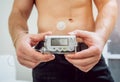 Diabetic man with an insulin pump connected in his abdomen Royalty Free Stock Photo