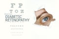 Diabetic retinopathy disease poster with eye test chart and blue eye