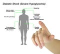 Diabetic Shock (Severe Hypoglycemia