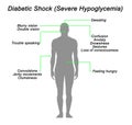 Diabetic Shock (Severe Hypoglycemia