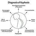 Diagnosis of kyphosis. Spinal curvature, kyphosis, lordosis, scoliosis, arthrosis. Improper posture and stoop Royalty Free Stock Photo