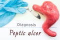 Diagnosis of Peptic Ulcer. Figure stomach, scalpel and surgical gloves lie near title Diagnosis Peptic Ulcer. Concept photo of cau