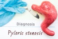 Diagnosis of Pyloric Stenosis. Figure stomach, scalpel and surgical gloves lie near title Diagnosis Pyloric Stenosis. Concept of c Royalty Free Stock Photo