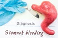 Diagnosis of Stomach Bleeding. Figure stomach, scalpel and surgical gloves lie near title Diagnosis Stomach Bleeding. Concept phot