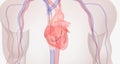 The Diagnostic Right Heart Catheterization