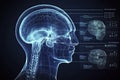 Diagnostics and treatment of diseases of the brain with modern research. Concept of x-ray examination of the brain. Diagnostics,