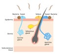 Diagram of body odor and sweat glands. Human skin layer illustration for medical and health care use