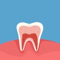 Diagram of a cross section of a tooth showing the layers of enamel, dentin, pulp with blood vessels and nerves Royalty Free Stock Photo