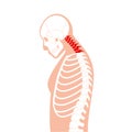 Neck vertebrae deformity