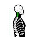 Neck vertebrae deformity