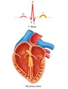 Diagram of heart T-waves Royalty Free Stock Photo
