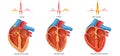 Diagram of heart waves Royalty Free Stock Photo