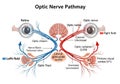 Diagram illustrating the optic nerve pathway. Includes eyes, optic Royalty Free Stock Photo