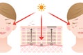 Diagram of regular skin cell turnover and slow skin cell turnover