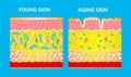 The diagram of younger skin and aging skin