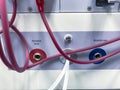 Dialysis Machine with Tubing and Dialyzer