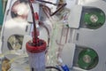 Dialyzer with two upper ports, on backgroud dialysis machine in ICU in hospital