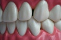 Diastema between the upper incisors is a normal feature