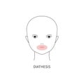 Diathesis in baby