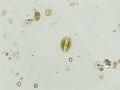 Diatoms under microscopic view Royalty Free Stock Photo