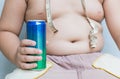 Diet. Obese fat boy holding soft drink can. Royalty Free Stock Photo