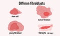 Diffcron of fibroblasts, cell growth. Stem cell and young fibroblast.