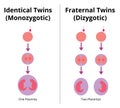 Difference between identical and fraternal twins. Royalty Free Stock Photo