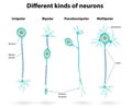 Different kinds of neurons