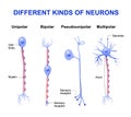 Different kinds of neurons Royalty Free Stock Photo