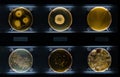 Different samples with kinds of bacterias living at common household items- mattress, shoe, moisturizer. Penicillium crateriforme